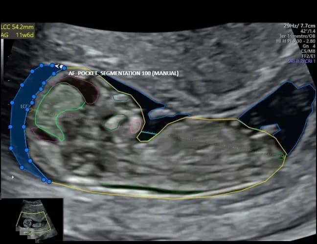 Fetal Annotation